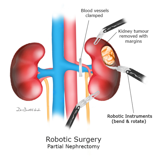 Robotic-Surgery.png