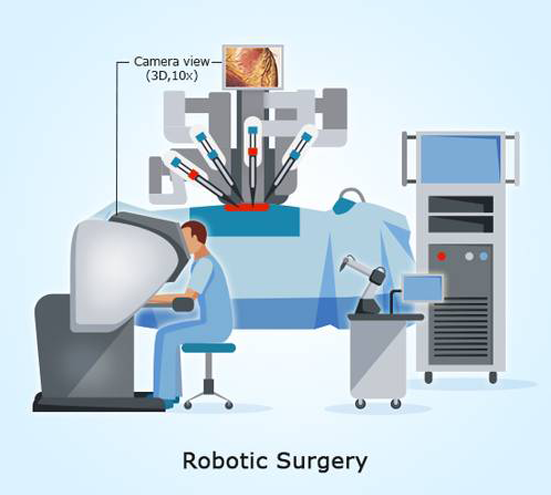 Robotic-Surgery-2.png