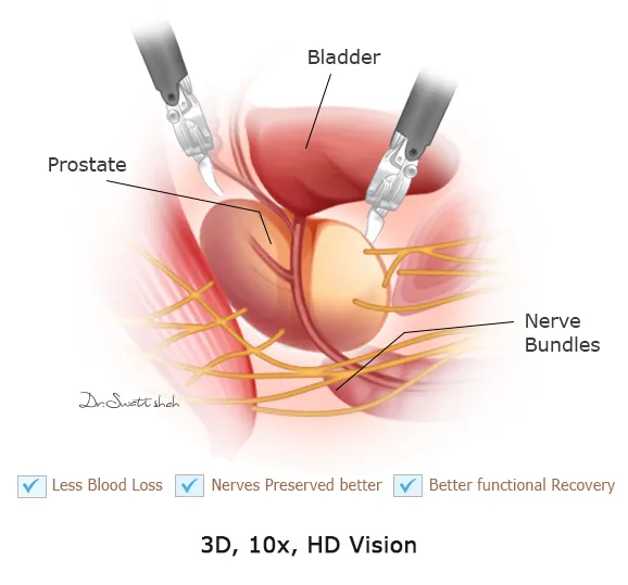 3D, 10x,HDVision of robotic surgery