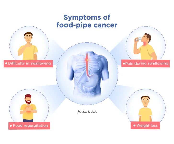 Symptoms-of-Food-pipe-cancer