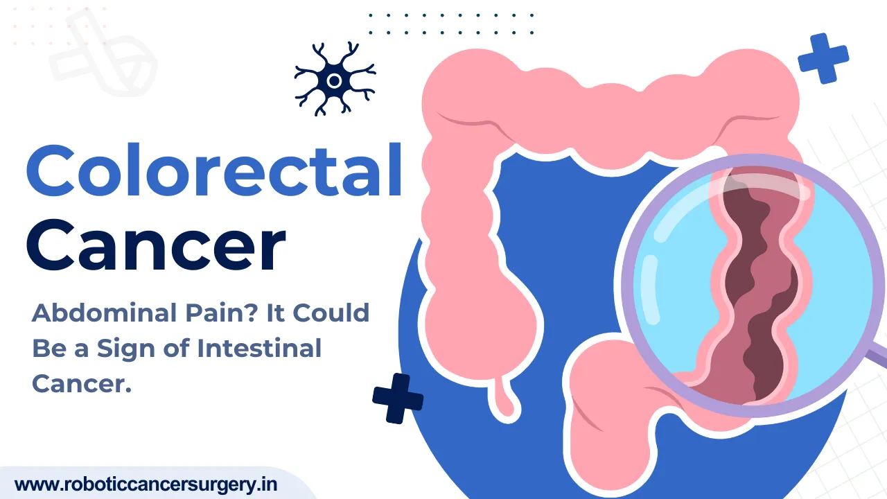 Colorectal Cancer / Irregular pain in your abdomen?