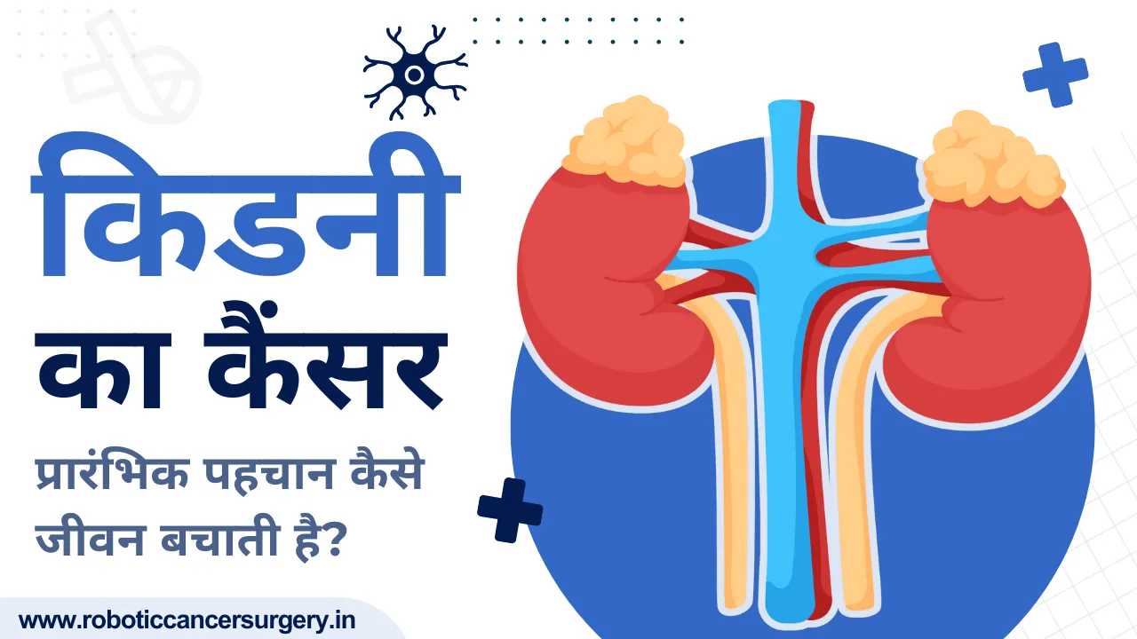 किडनी का कैंसर: प्रारंभिक पहचान कैसे जीवन बचाती है।