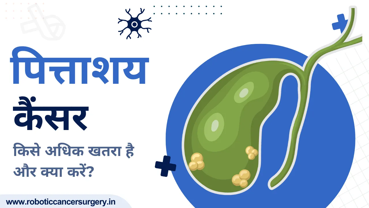 पित्ताशय का कैंसर: कारण, लक्षण और इलाज