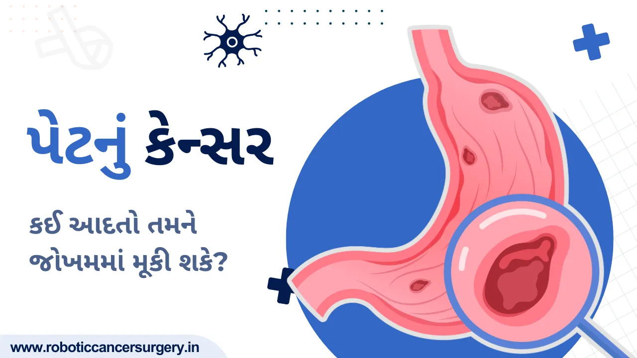 પેટનું કેન્સર: વહેલી તપાસથી જીવ બચી શકે છે