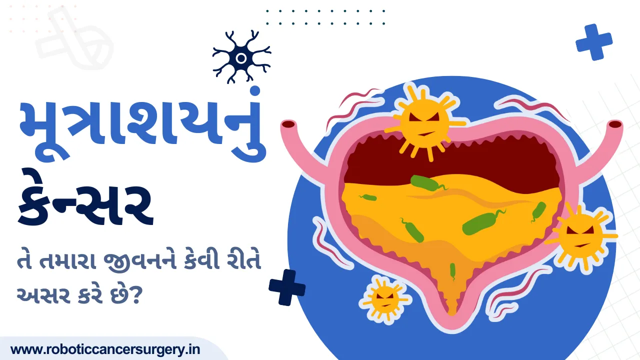 મૂત્રાશયનું કેન્સર: તે તમારા જીવનને કેવી રીતે અસર કરે છે?