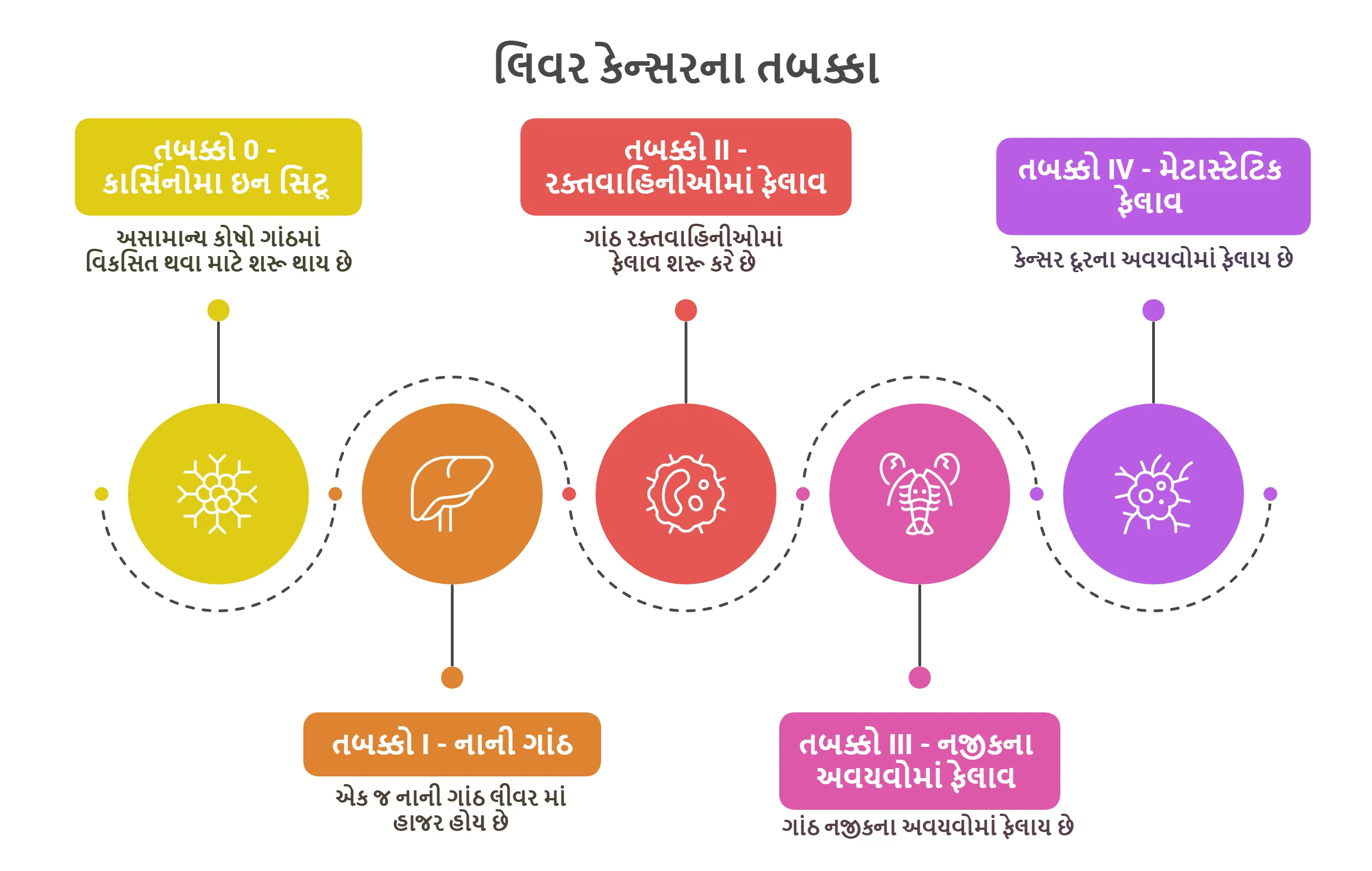 લિવર કેન્સરના તબક્કા
