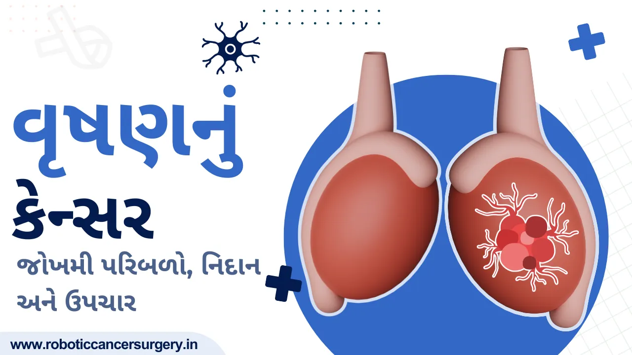 વૃષણનું કેન્સર: જોખમી પરિબળો, નિદાન અને ઉપચાર
