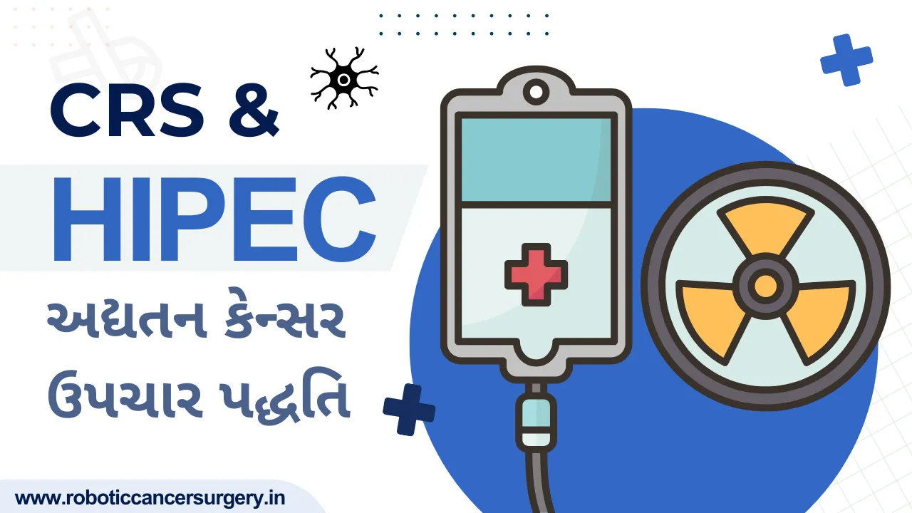 કેન્સરની સારવારમાં CRS અને HIPEC સર્જરી ની ભૂમિકા