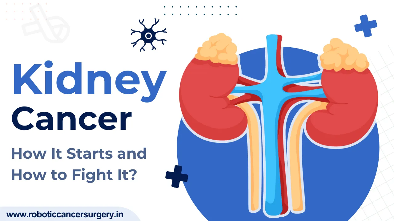 Kidney Cancer: Risk Factors, Prevention, and Early Detection