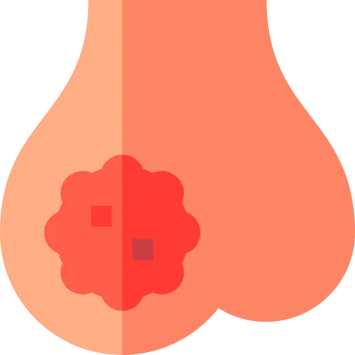 Painless Lump or Swelling