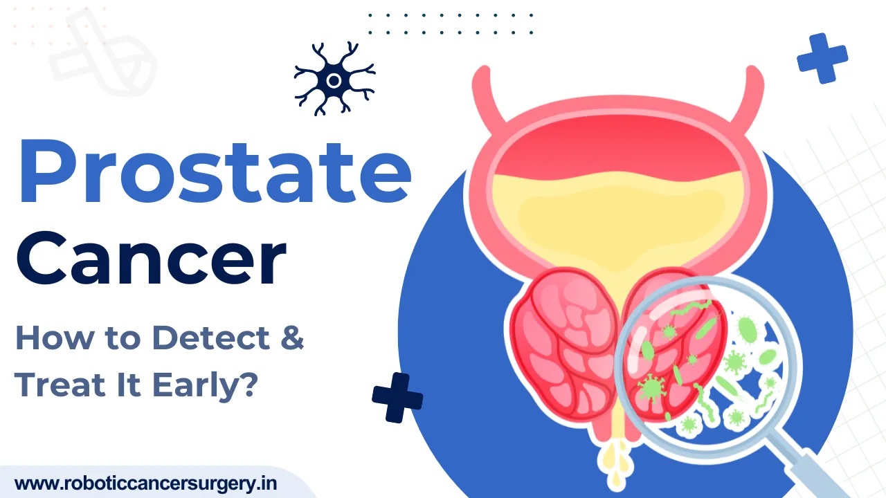 Prostate Cancer in Men: Early Signs, Causes & Treatment