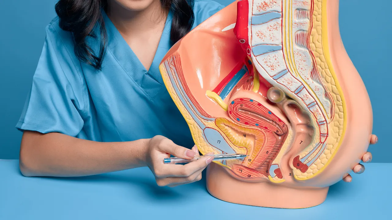 Radical Cystectomy
