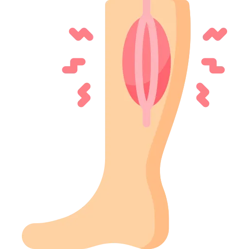 Swelling in Ankles and Legs