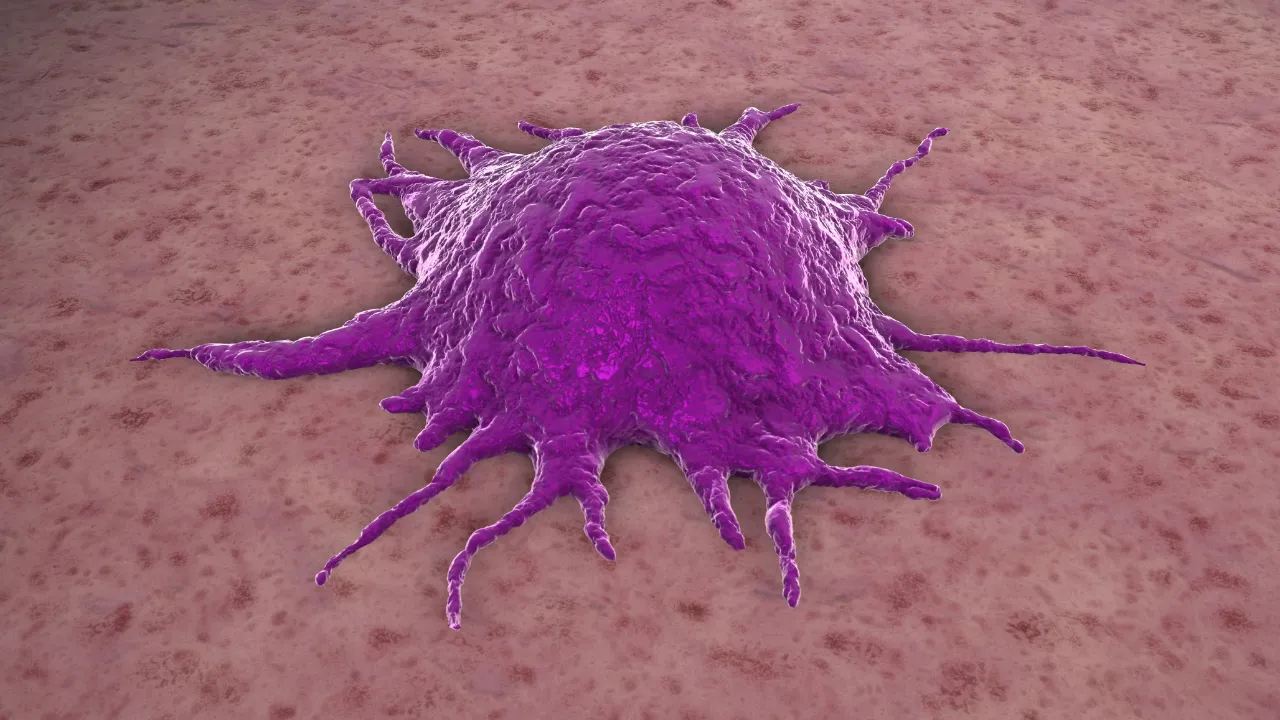 Transurethral Resection of Bladder Tumor