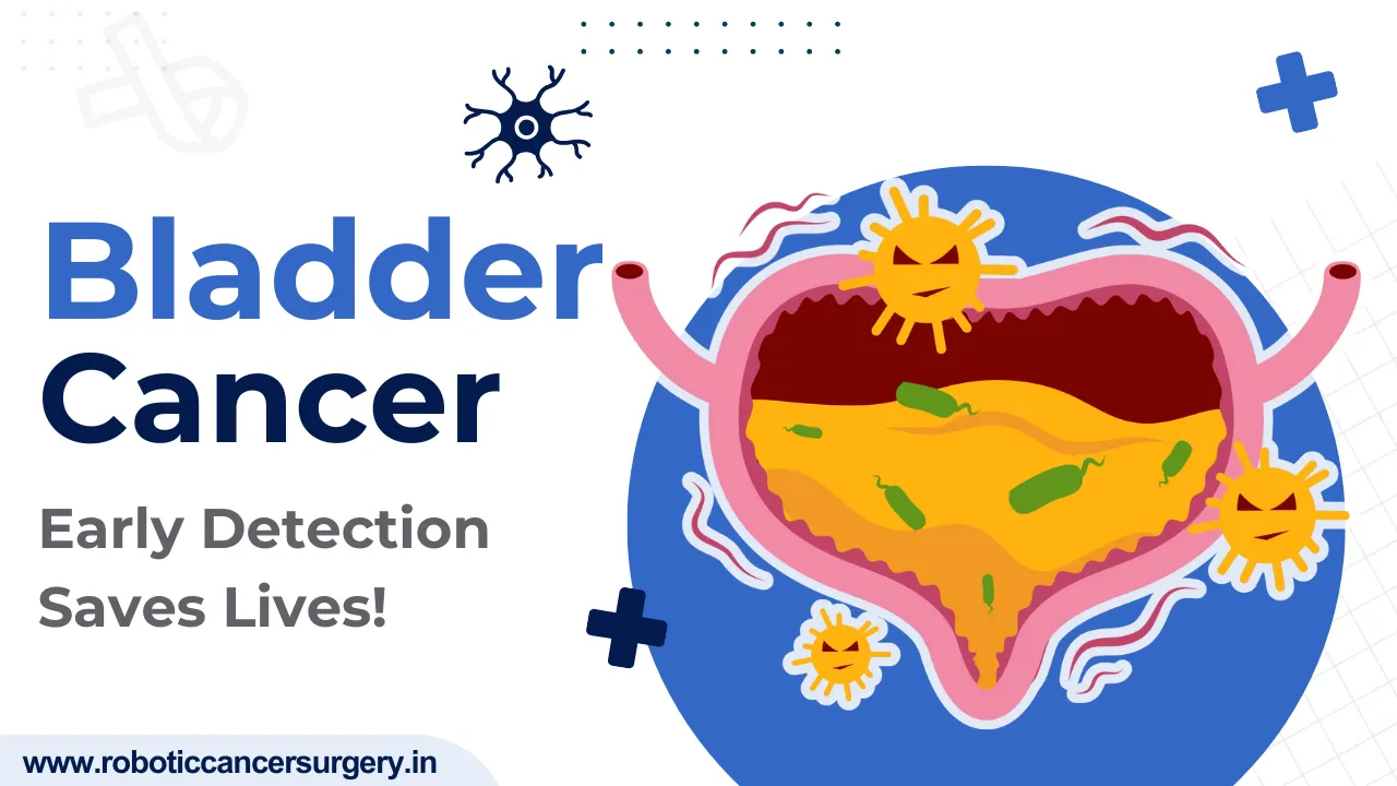 Urinary Bladder Cancer: How Does It Affect Your Daily Life?