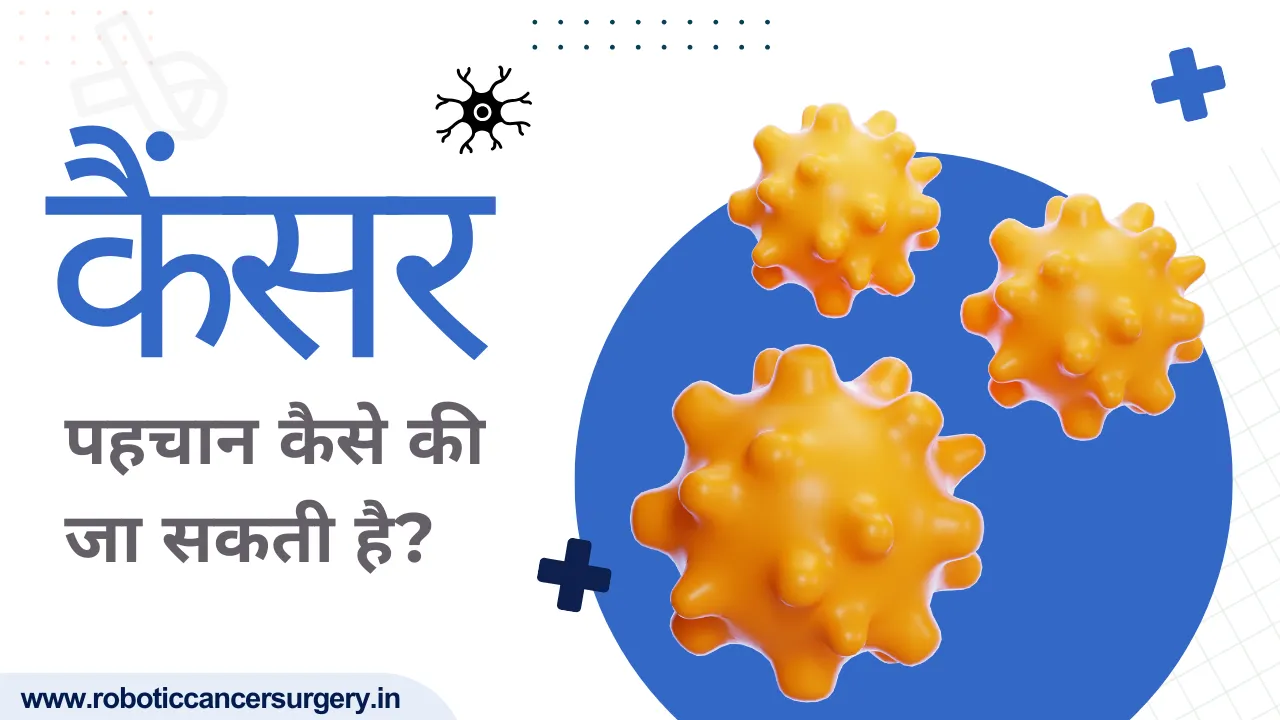 कर्करोग (कैंसर) क्या है?: प्रकार, लक्षण और उपचार