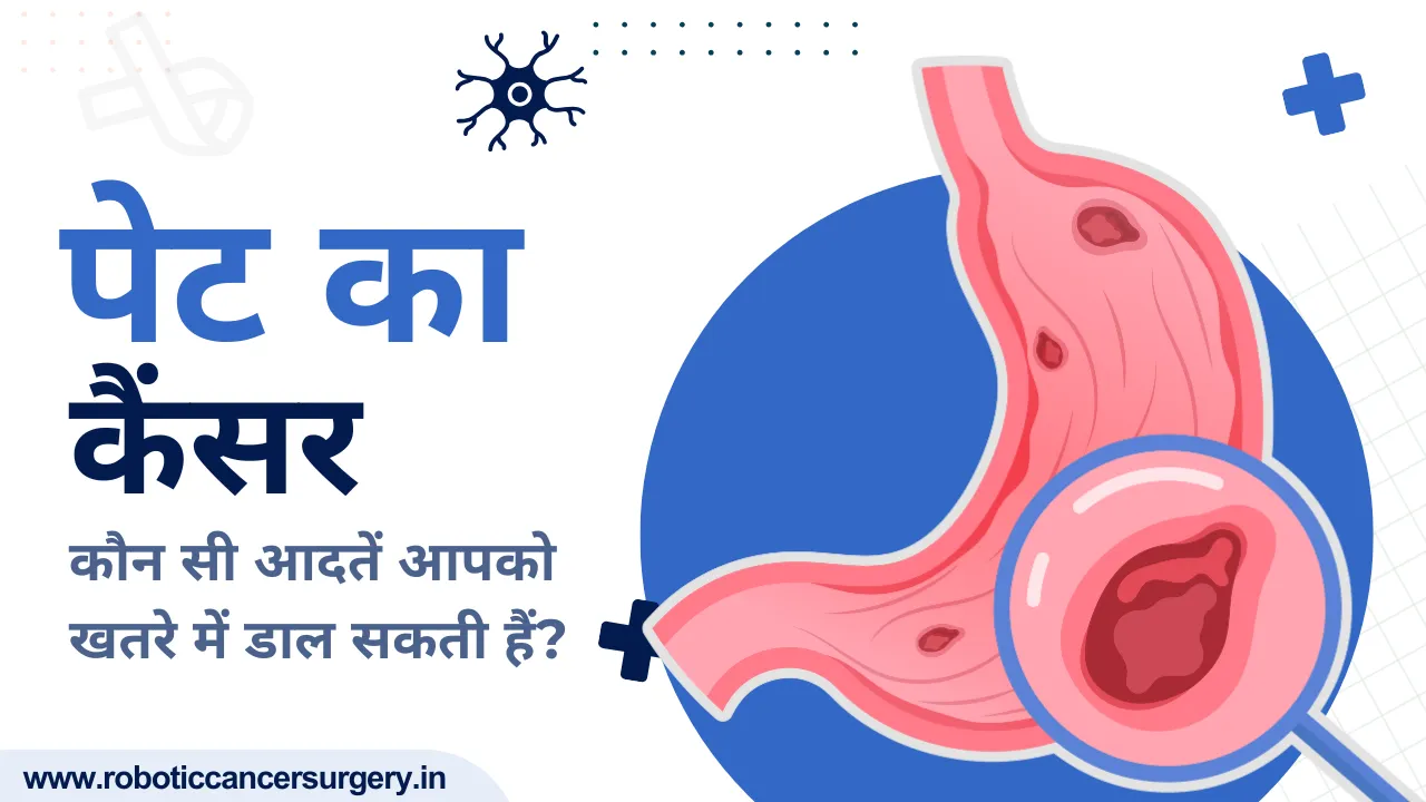 पेट का कैंसर: कारण, लक्षण और इलाज