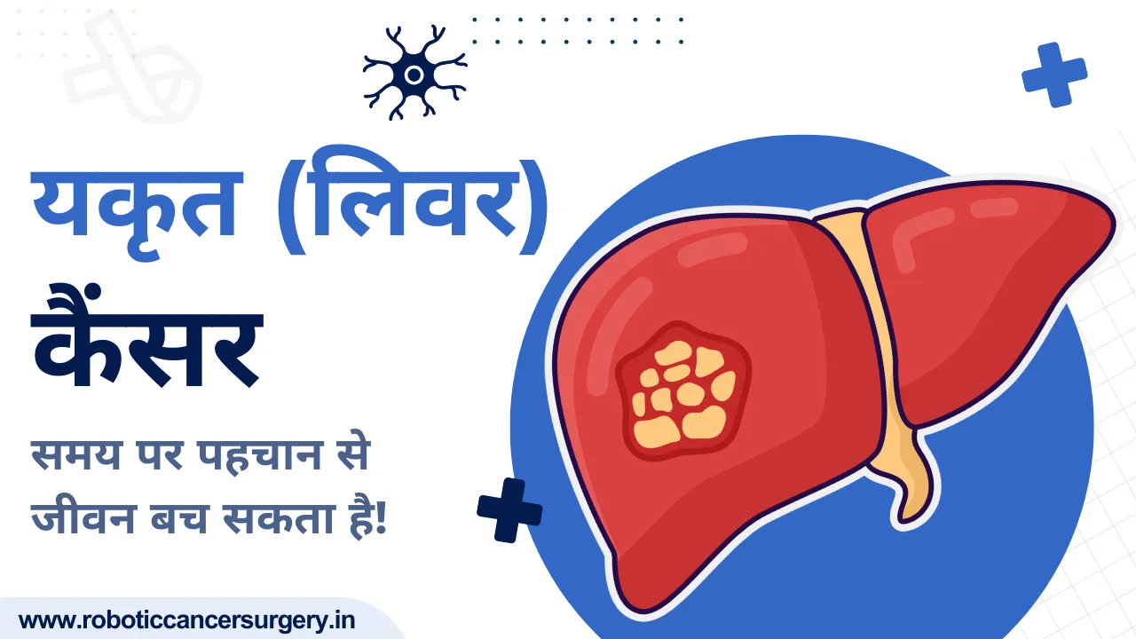 यकृत कैंसर: कारण, लक्षण और आधुनिक इलाज