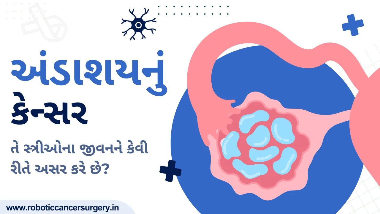 અંડાશયનું કેન્સર: તે સ્ત્રીઓના જીવનને કેવી રીતે અસર કરે છે?