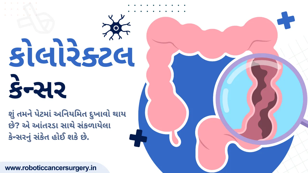 કોલોરેક્ટલ કેન્સર (આંતરડાનું કેન્સર)