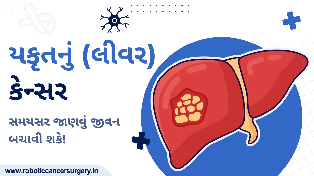 લિવર કેન્સર: નિવારણ, નિદાન અને સારવાર