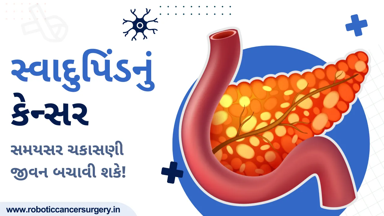 સ્વાદુપિંડનું કેન્સર: સારવાર મોડી પડે તો જોખમ વધી શકે છે