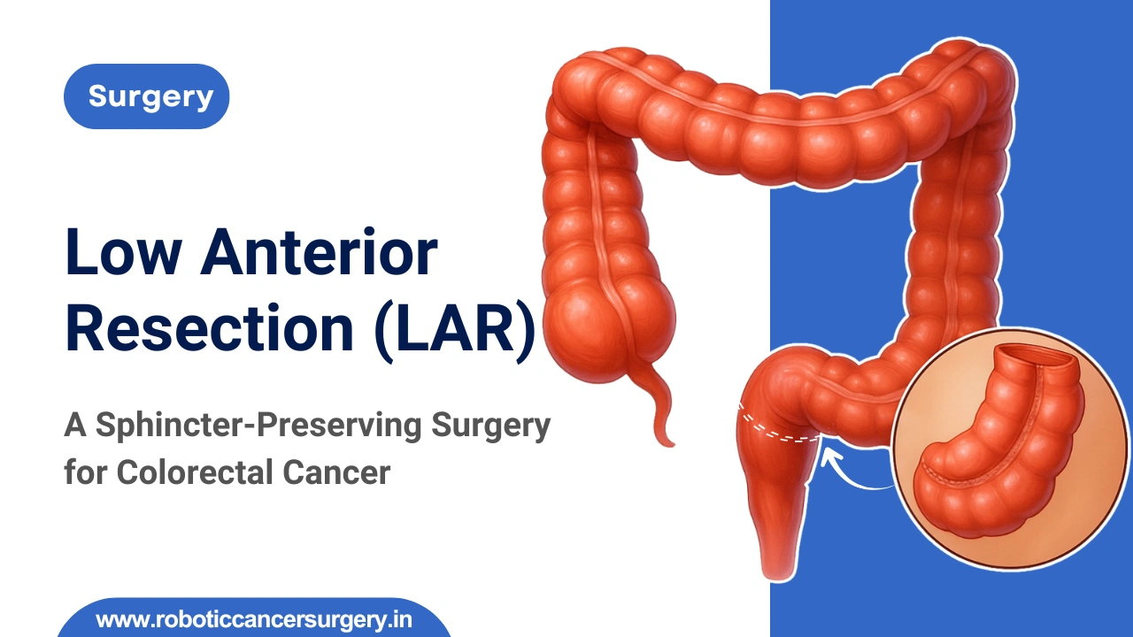 Low Anterior Resection Surgery: Procedure, Recovery, and Life After
