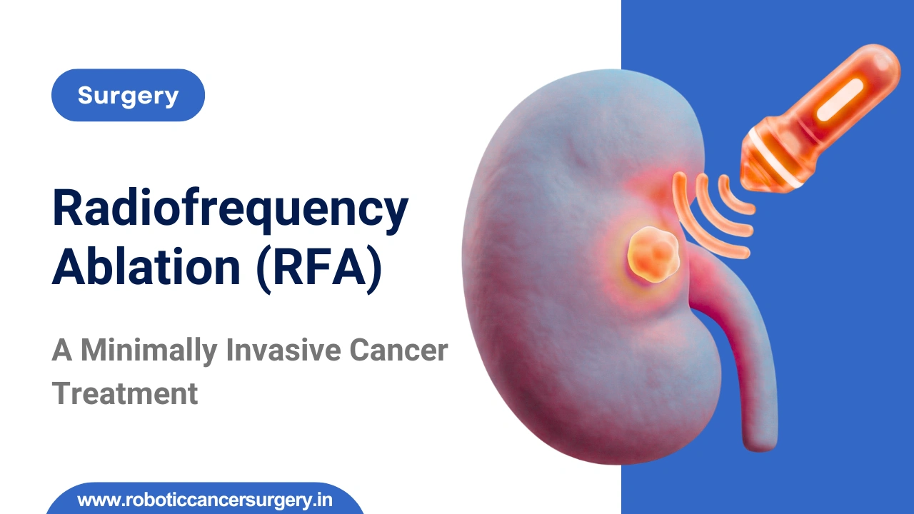 Radiofrequency Ablation for Liver Tumours