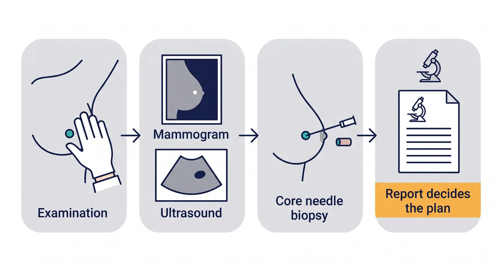 Four steps from a breast lump to a diagnosis: examination, mammogram and ultrasound, core needle biopsy, and the biopsy report that decides the plan